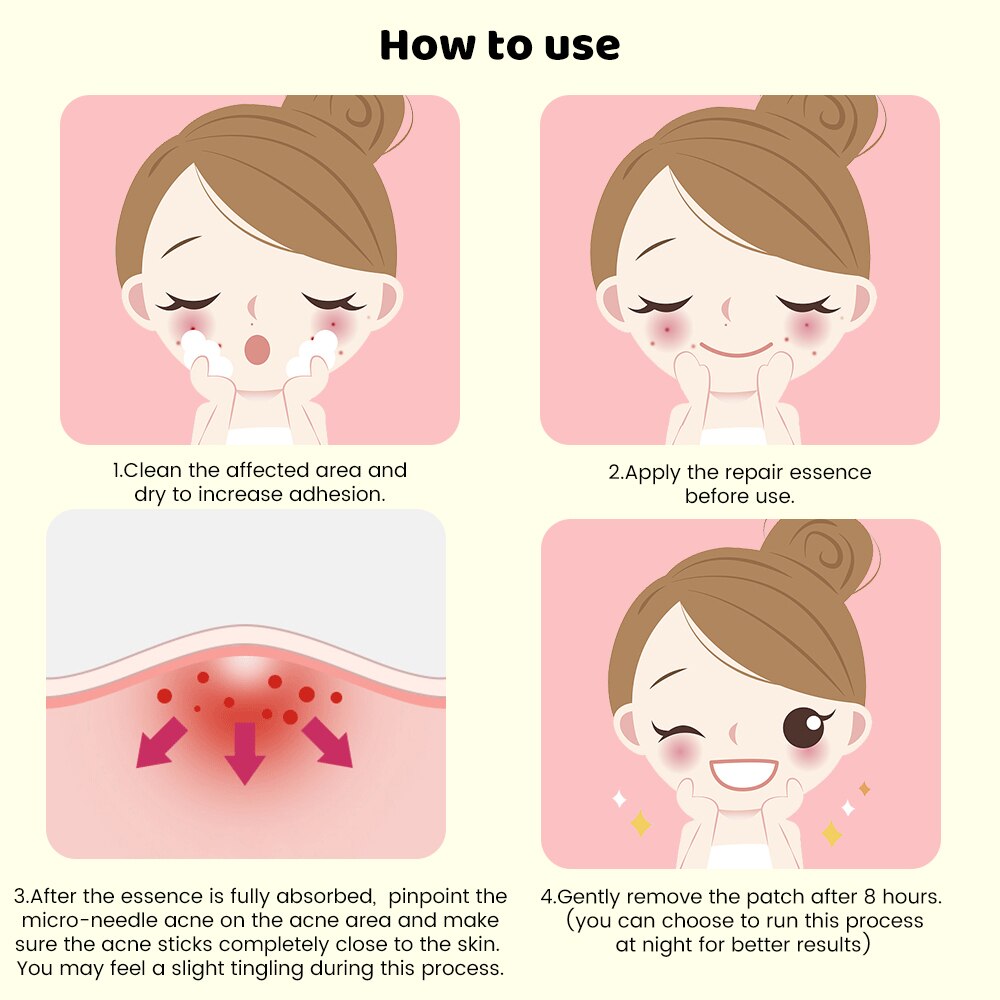 9pcs Translucent Microneedle Pimple Patch Acne Master Treatment Sticker Face Beauty Skin Care Tool Tape Skincare